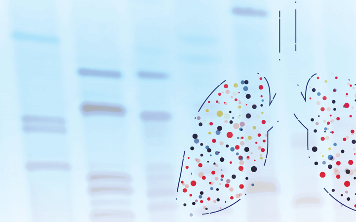 Integration of New Biomarkers and <br>Targeted Therapy in Advanced NSCLC:<br> Challenges and Solutions