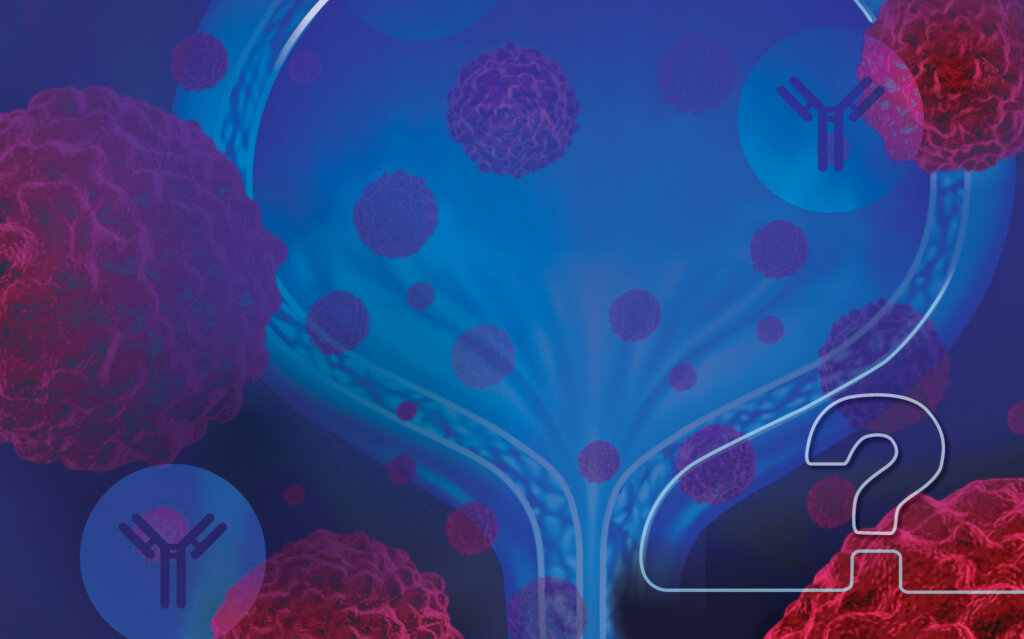 Transforming Care in Advanced Urothelial Cancer with Immunotherapy: Frequently Asked Questions