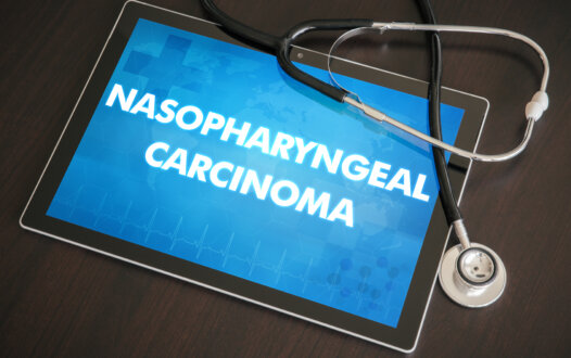 First-Line Anti-PD1 Plus Chemotherapy Combo Justified in Advanced Nasopharyngeal Cancer